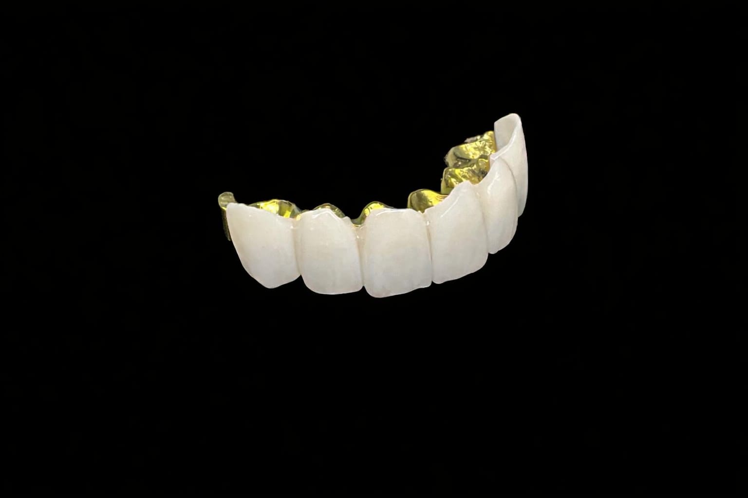 Coronas y puentes en zirconio